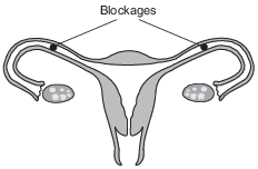 reproduction and development, human female reproductive system fig: lenv82015-exam_g5.png